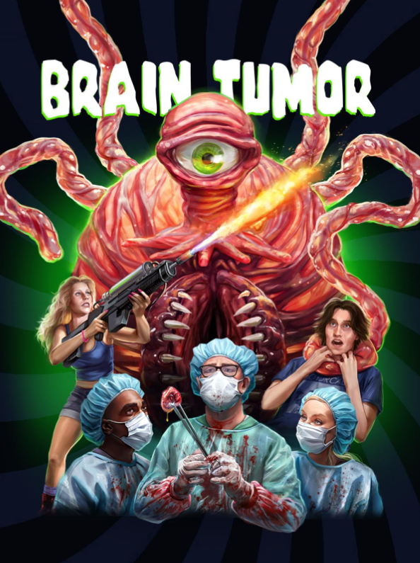 Опухоль мозга (2024)